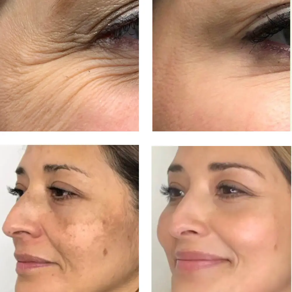 Before_and_after_for_funnel_copy