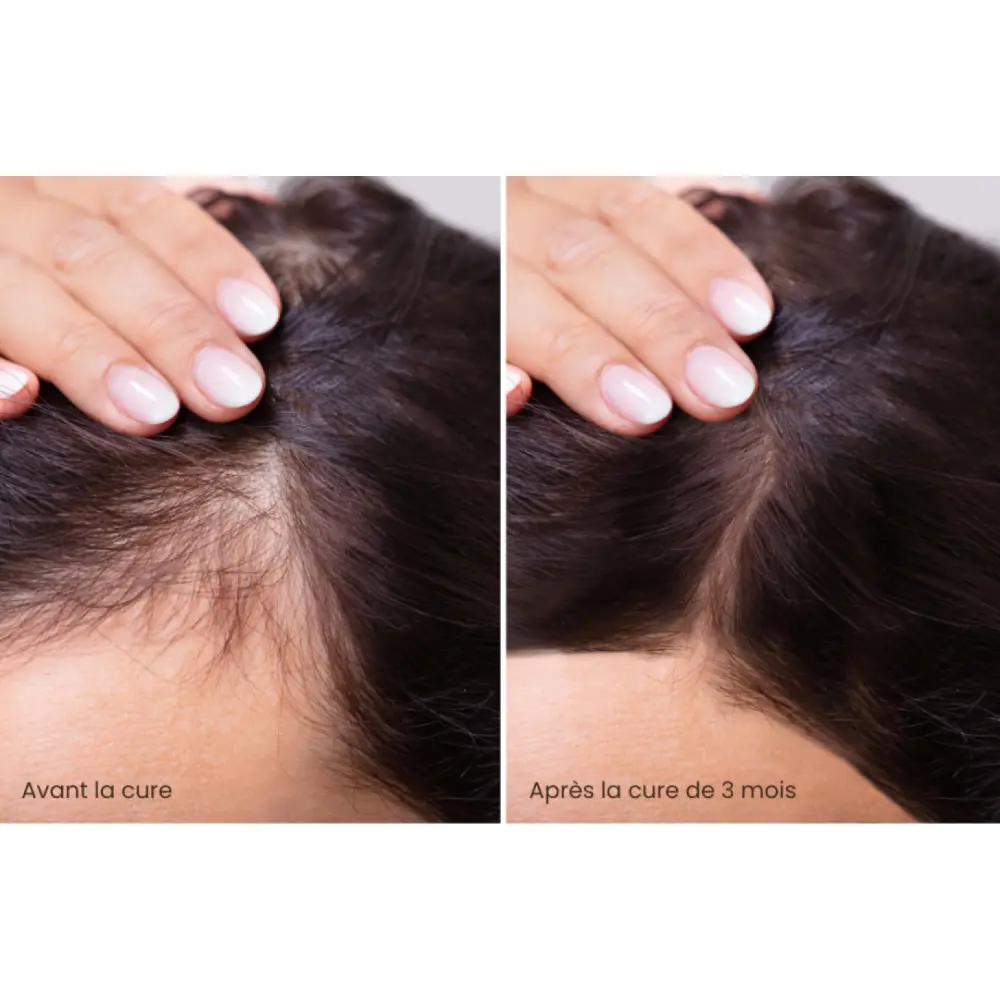 CureHairBoost