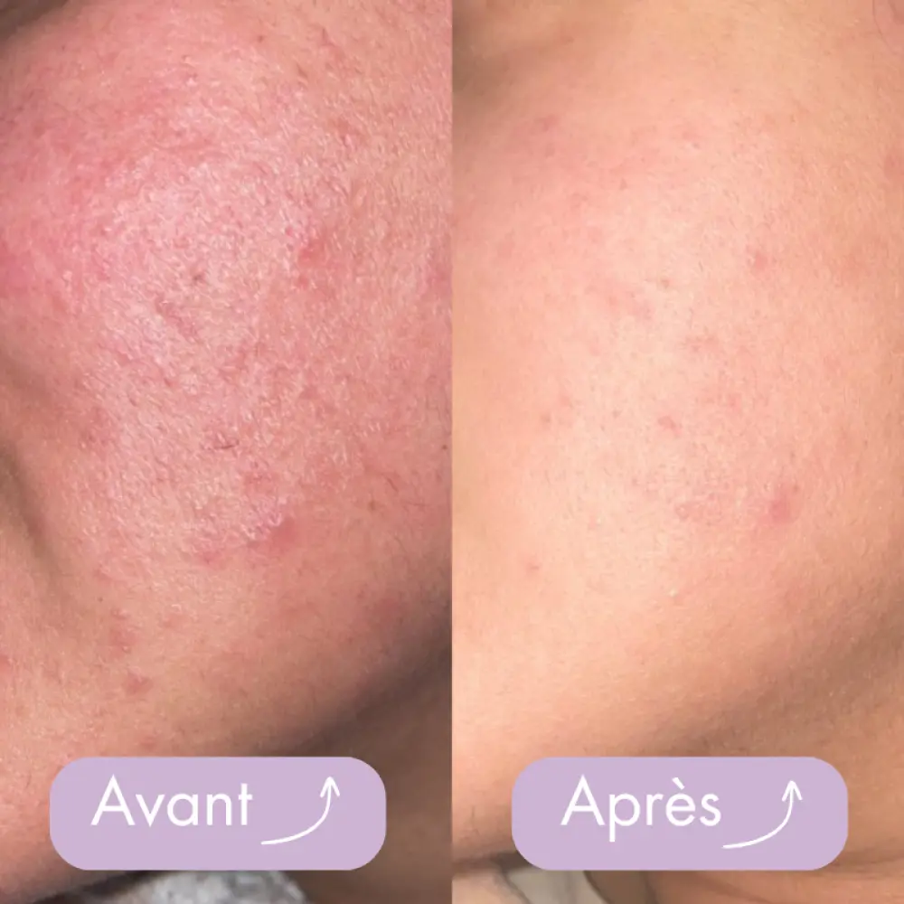 Sanstitre_800x800px_7cc3ac2d-3cc3-4c9d-960d-e6011ebce0cb