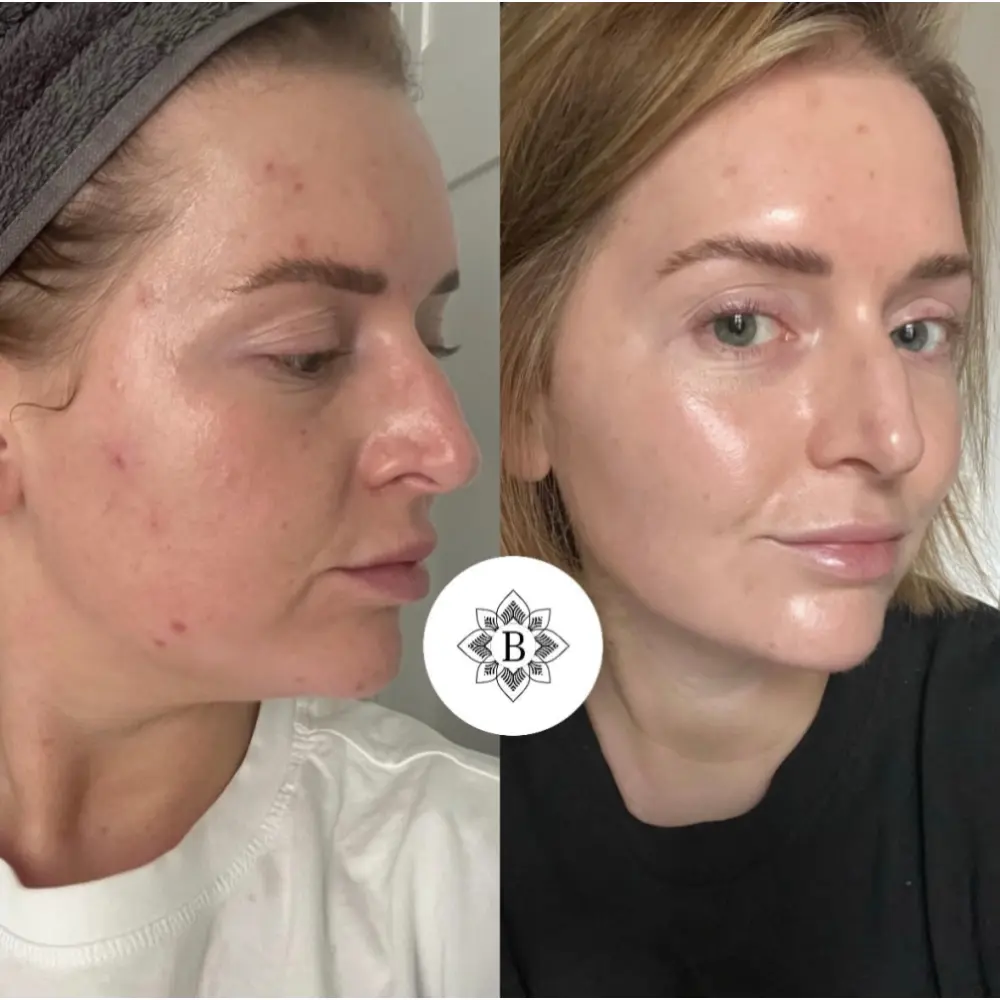 3DF63D04-4250-4679-BEFB-8F0966AD3C4D_4eb2a24f-b8a3-4c8d-94e6-40bbf2e6f6fa_1024x1024@2x