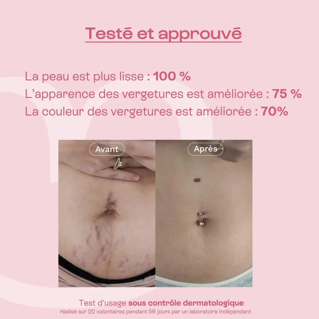 EXP100 Efficacité