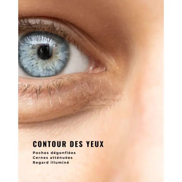 Anti-Tränensäcke Cream gegen Augenringe