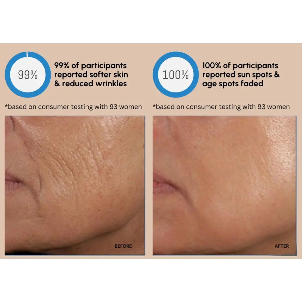 consumer_survey_before_and_after