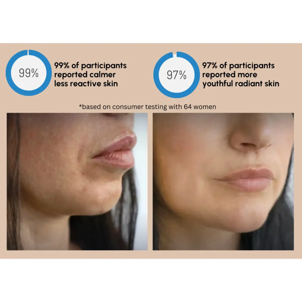 Swiss_Toniq_anti_ageing_for_sensitive_skin_reactive_skin_allergic_skin_irritated_skin_rosacea_solution_gently_skincare_gentle_anti_ageing_antiaging_swiss_antiaging_best_antiaging