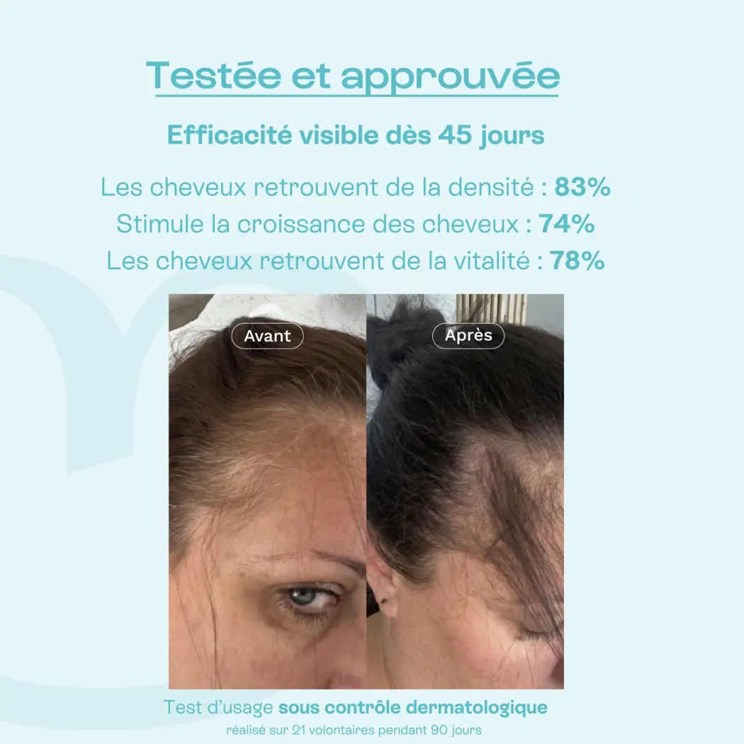 Mon Coup de Pousse - Lotion anti-chute — Omum