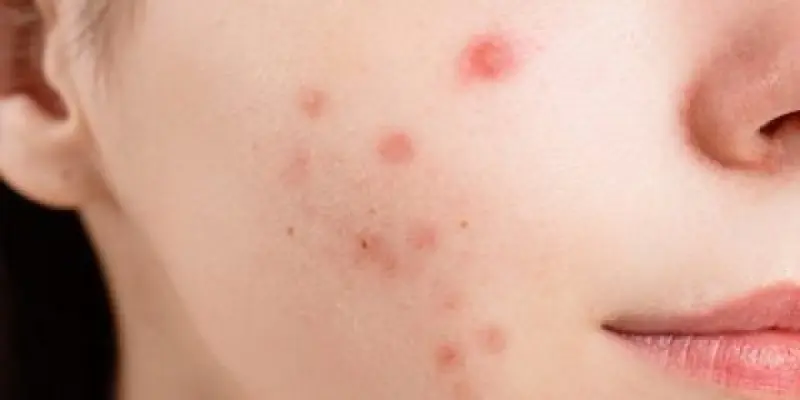 pexels-anna-nekrashevich-6475987-400x250-1